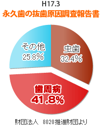 永久歯の抜歯原因調査報告