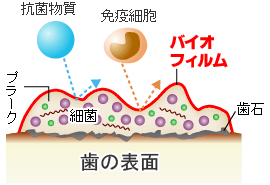 歯周病菌の要塞！ バイオフィルム