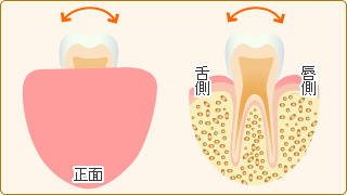 歯の動揺度検査