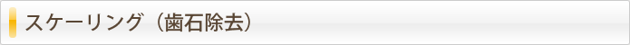 スケーリング（歯石除去）
