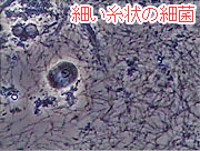 歯周病の原因となる代表的な細菌“スピロヘータ”