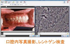 歯周内科治療１回目。初診。口腔内写真撮影、レントゲン検査。