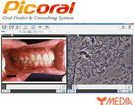 歯周内科治療に特化したPicoral「歯周病コンサルティング・カウンセリングシステム」