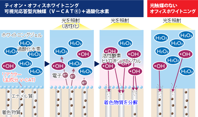 ティオン・オフィスと通常のオフィスホワイトニングの比較