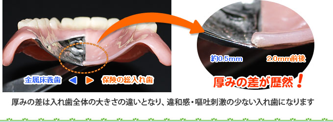 保険の入れ歯と金属床義歯の大きさの比較