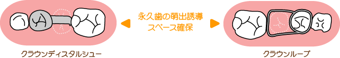 永久歯の誘導管理