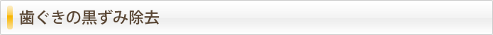歯ぐきの黒ずみ除去