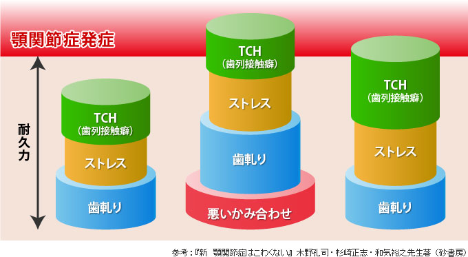 顎関節症発症の考え方